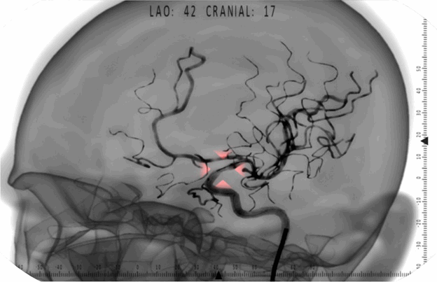 0331_Eidos-Medicine-PVS-Studio/image4.png